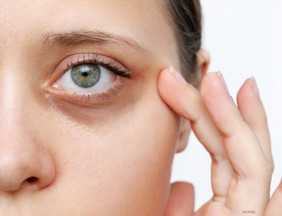 stock image of model pointing her eye