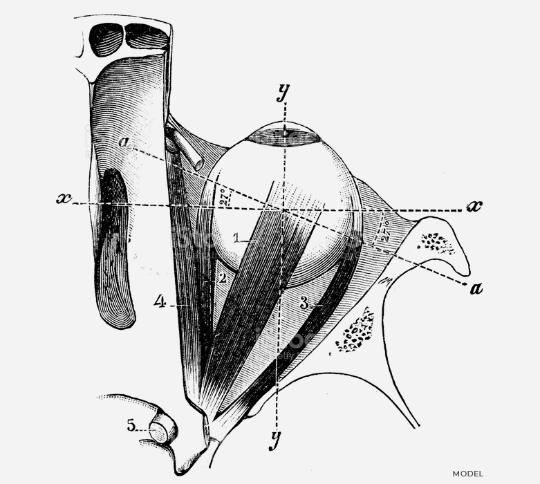 stock image of diagrammatic view of enucleation procedure