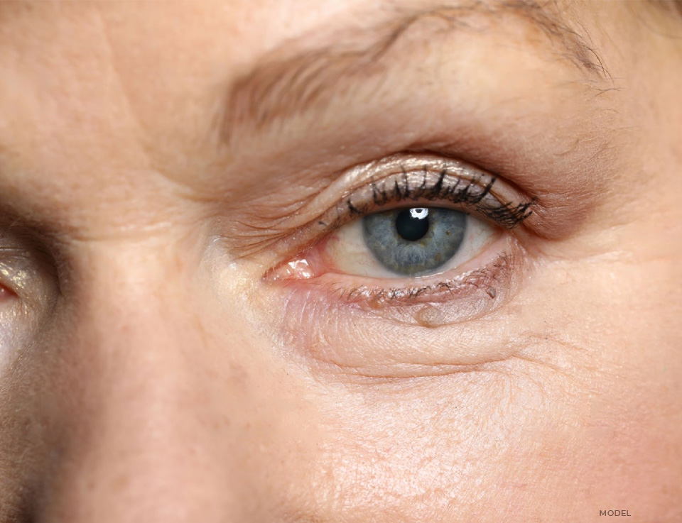 stock image of model showing her single eye