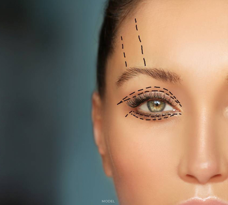 stock image of model have sketch marks around her eye