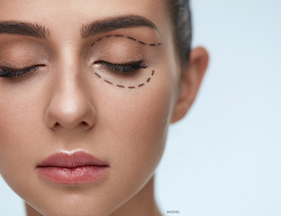 stock image of model having sketch around her eyes