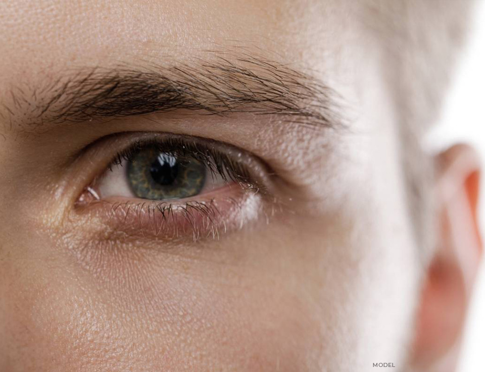 stock image of model showing her eye