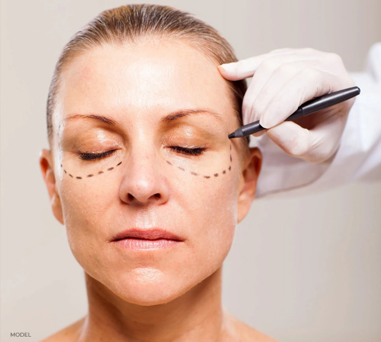 stock image of model having sketch marks around her eyes