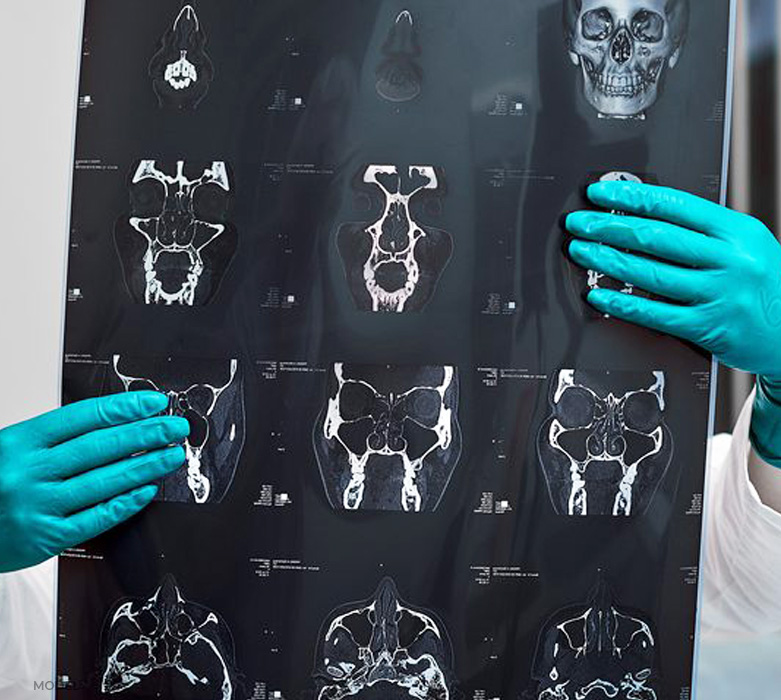 stock image of model showing x-ray