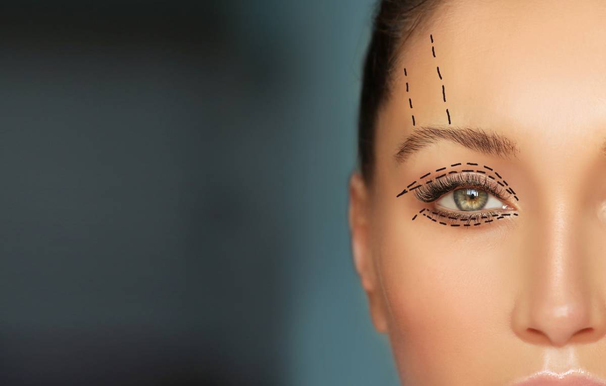 Different Types of Eyelid Surgery Chicago Oculofacial Consultants Blog