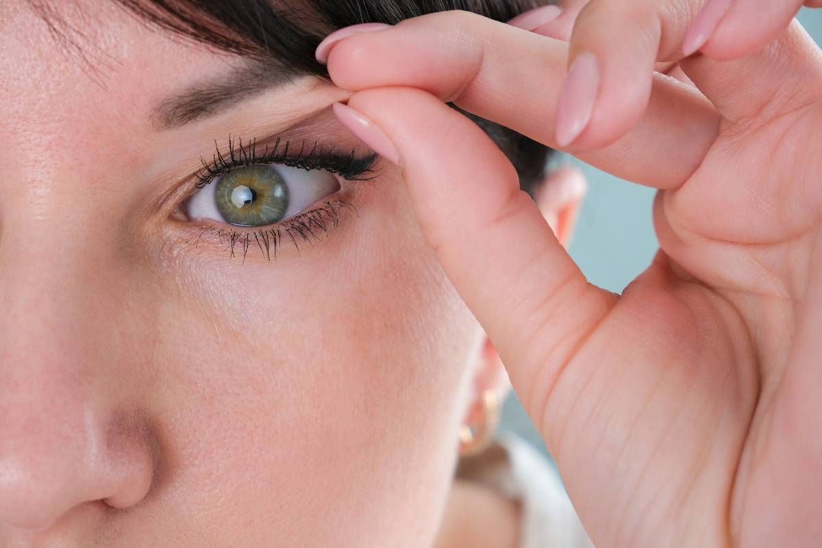 Woman lifting her eyelid to show drooping, potential nerve damage and ptosis eyelid drooping.